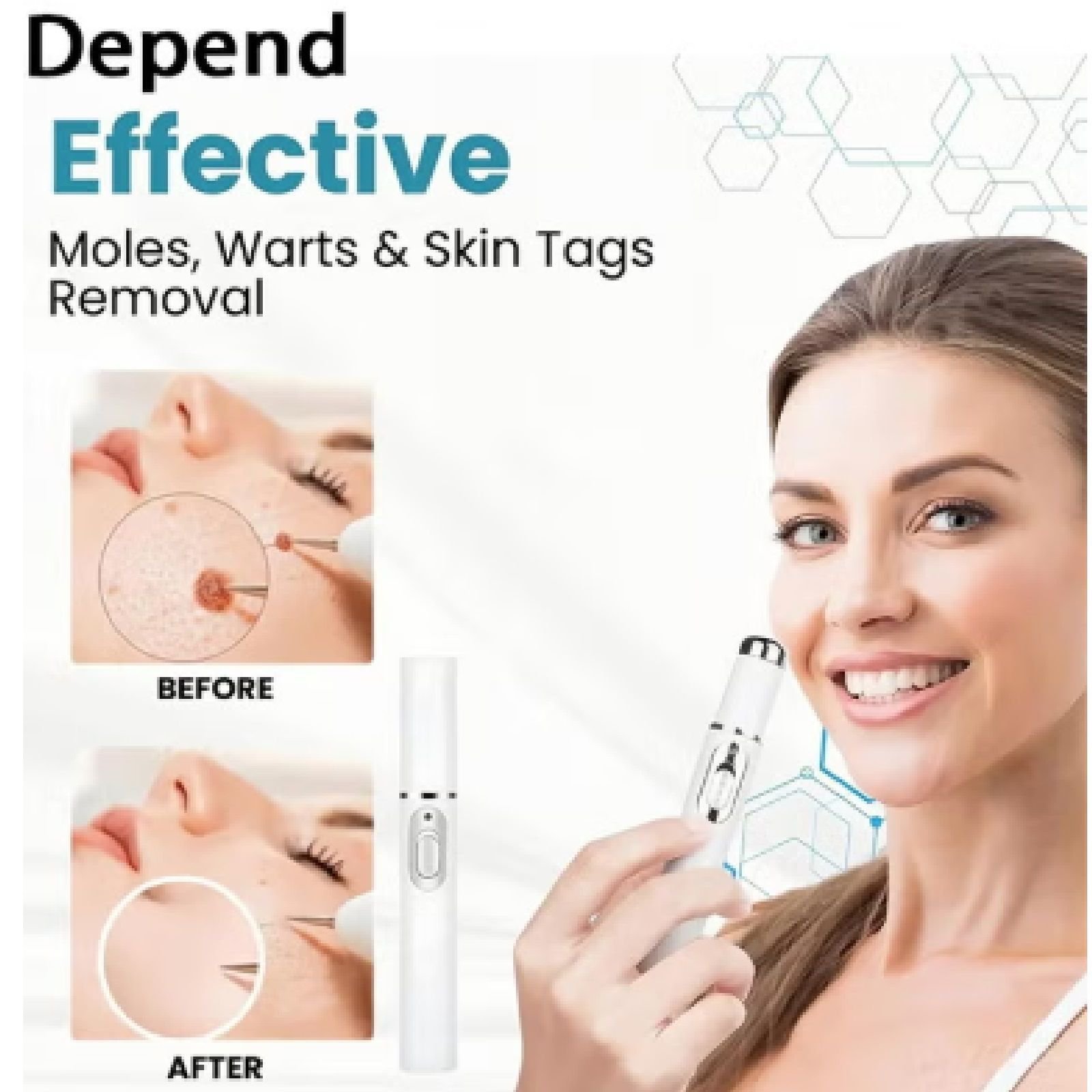 2026/02/mole-and-wart-removal-pen-non-invasive-mole-and-wart-removal-28492-290.jpg Mole And Wart Removal Pen Non Invasive Mole And Wart Removal - Image 1